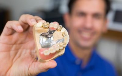 4 Tips on Finding the Best Place to Sell Dental Gold