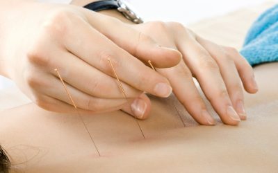 Feel Better Naturally with Expert Acupuncture Services in Newark, CA