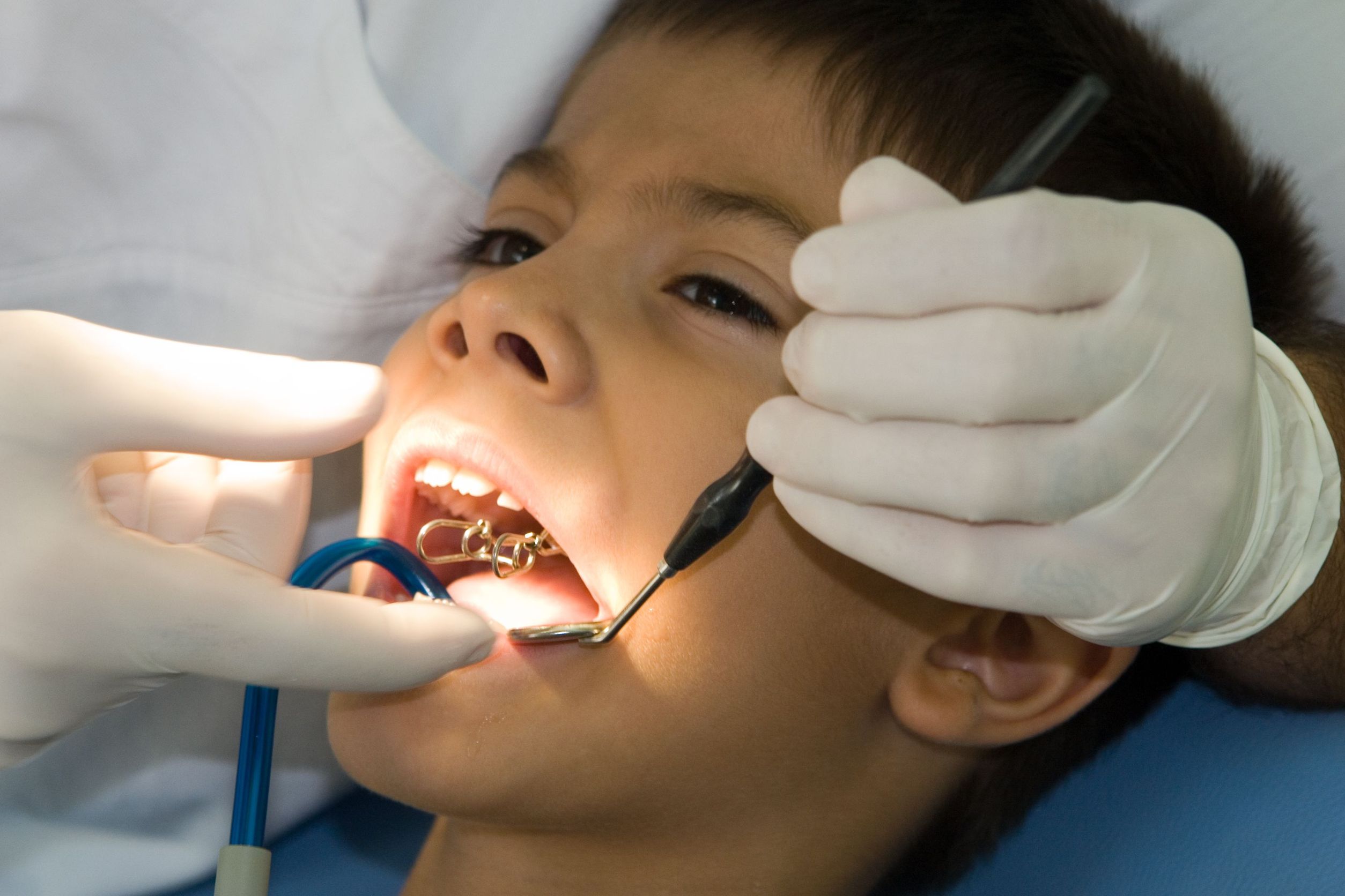 It’s Important to Have a Good Children Dentist in New Hyde Park, NY