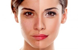 Non Invasive, Non Surgical De-aging Techniques Seeing Growth