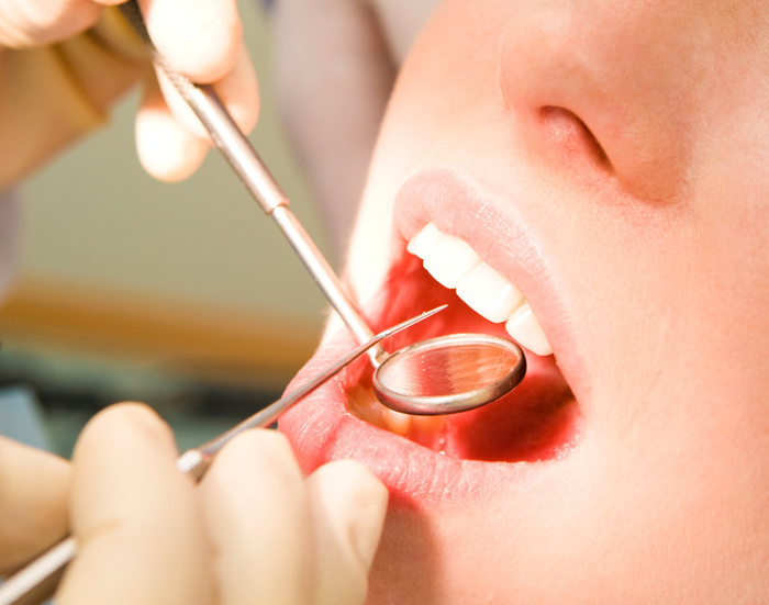 2 Benefits of Having a Cosmetic Dental Procedure in Fairfield Ct